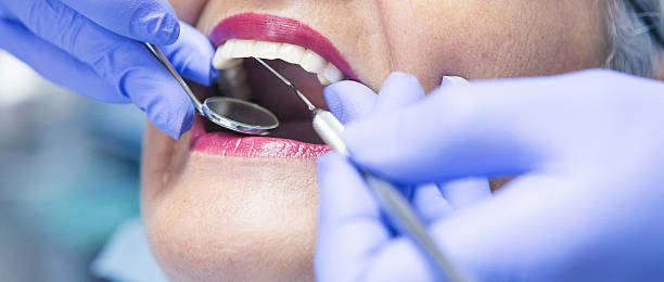 Best Emergency Dental Care for Broken or Chipped Teeth in Nibley, UT